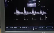 Zapis prędkości przepływu przy użyciu ultrasonografii dopplerowskiej